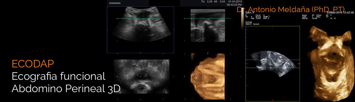 ECODAP: Ecografia funcional Abdomino Perineal 3D ECODAP: Ecografia funcional Abdomino Perineal 3D